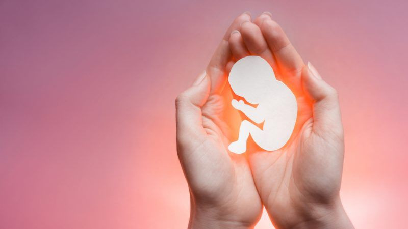 Abortion